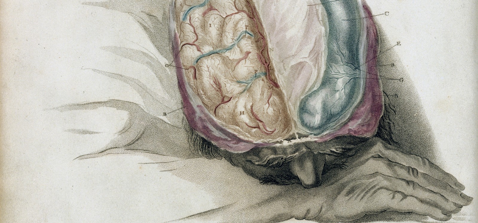 As Stubborn as a Brain