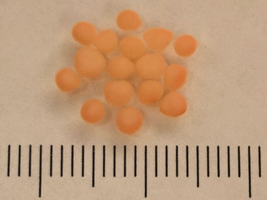 „Sferoid korowy”, mini-mózg wyhodowany w laboratoriach Stanford University to na pierwszy rzut oka maleńka, niepozorna kulka o średnicy kilku milimetrów.