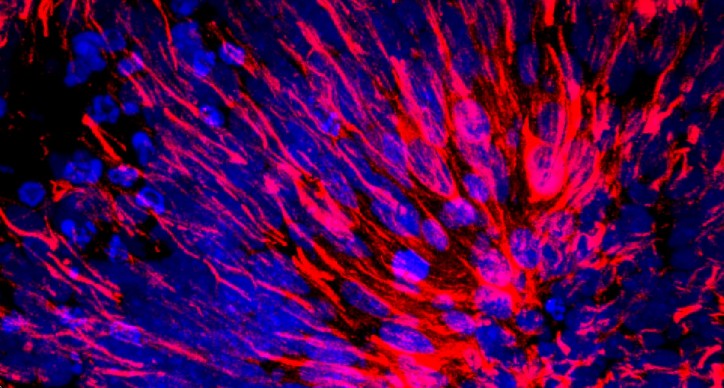 Zabarwiony przekrój „mini-mózgu”, modelu ludzkiej kory. Neurony mają kolor niebieski, astrocyty (komórki o nieregularnym kształcie) mają kolor czerwony.
