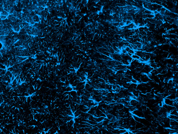 2) stained glial cells in a rat’s brain. Source: Orchinik Lab, Arizona State University – Creative Commons