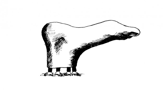 Amputacja